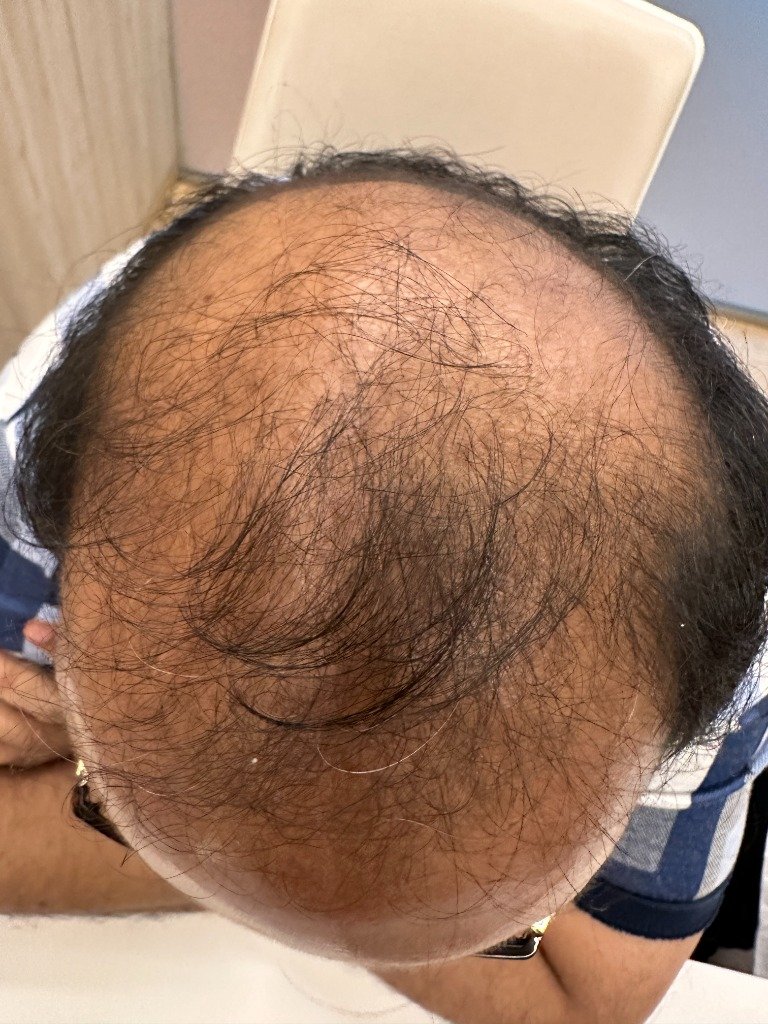 After Treatment